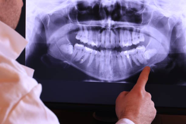 Best Emergency Dental Care for Sports Injuries in Limestone Creek, FL